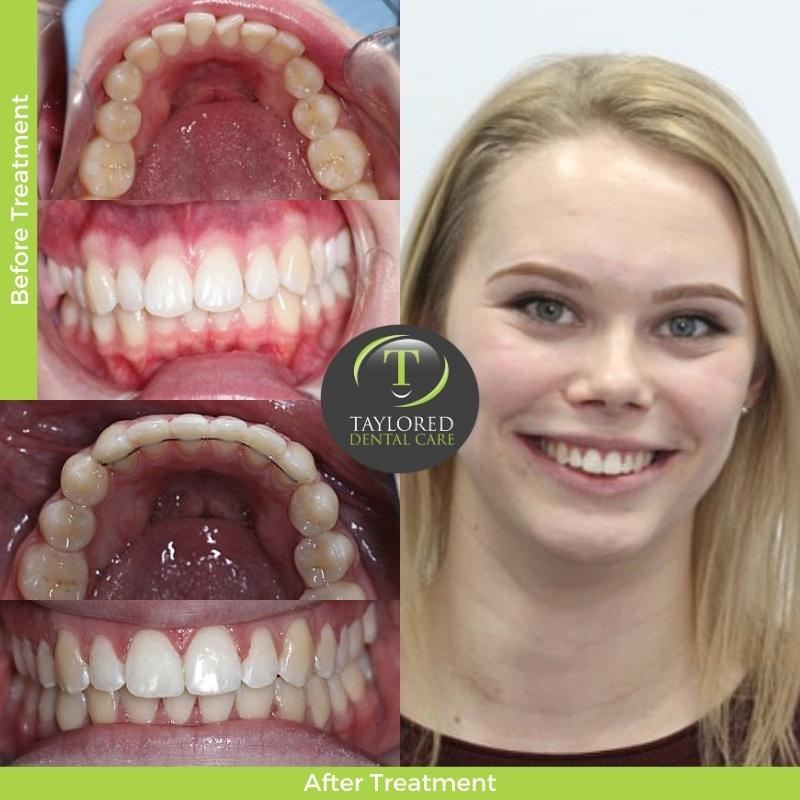 Changing Smiles At Taylored Dental